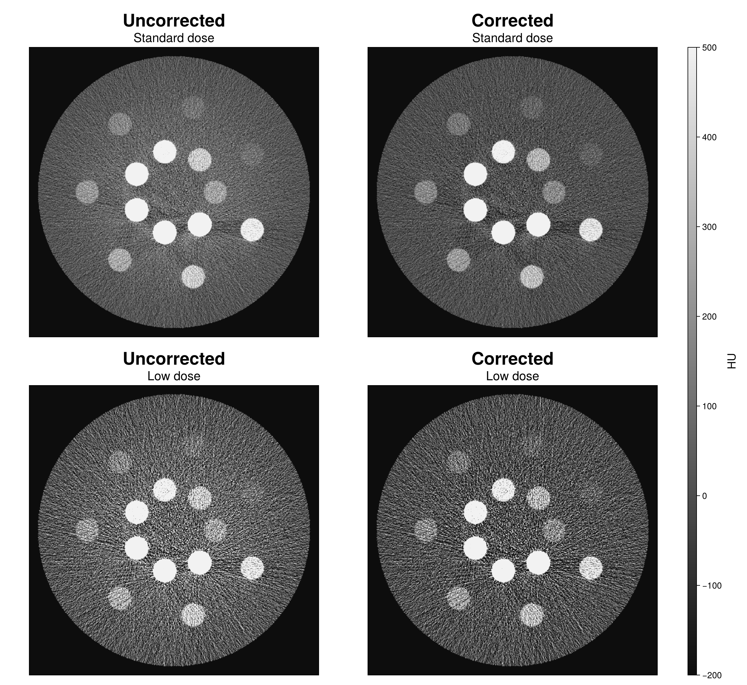 Standard vs low-dose reconstruction, raw vs corrected
