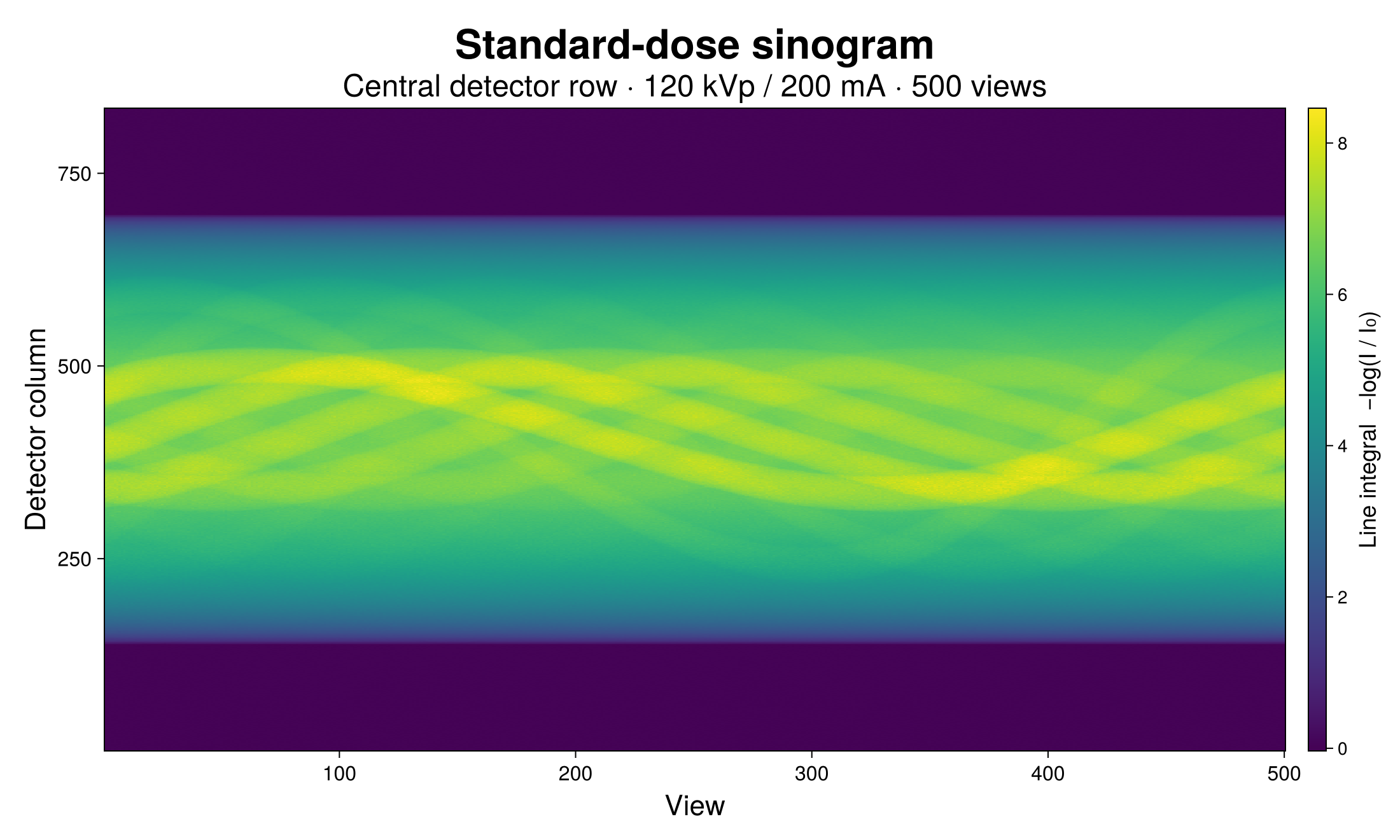 Standard-dose sinogram (central detector row)