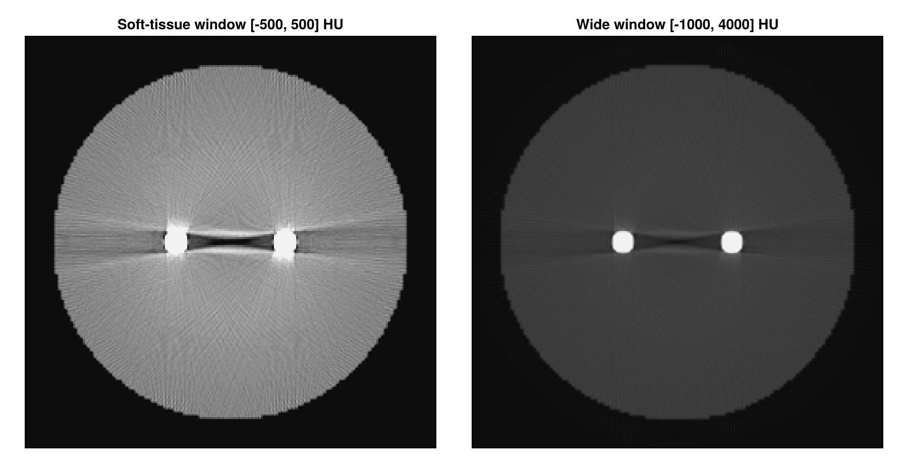 Titanium Implant — Metal Artifacts from a User-Defined Material